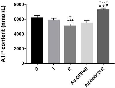 SIK2 Improving Mitochondrial Autophagy Restriction Induced by Cerebral Ischemia-Reperfusion in Rats